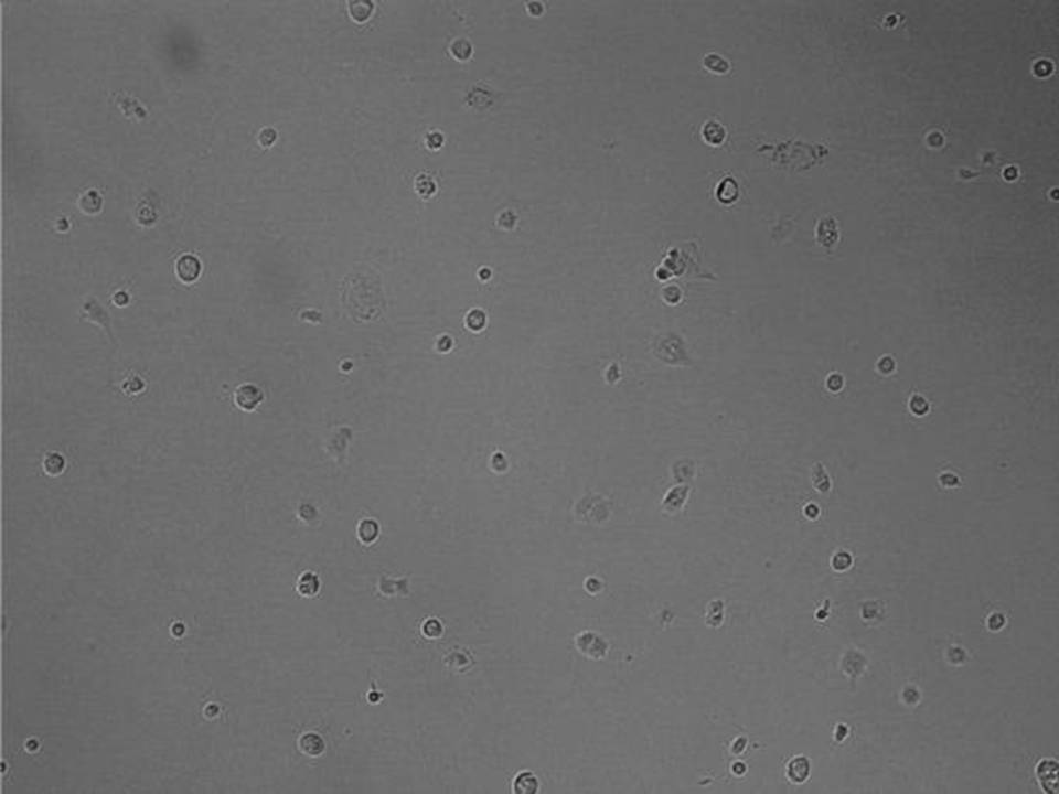 NEPA21 / TS - Mouse Trophoblast Stem cells - Viability 59 per cent